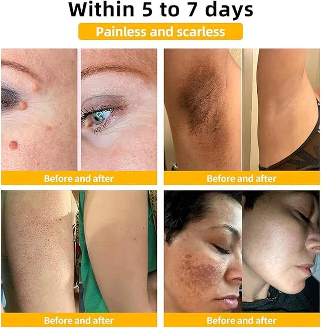 Bee Venom Skin Treatment Cream,Repair Maximum Strength for All Skin Types (1PCS)