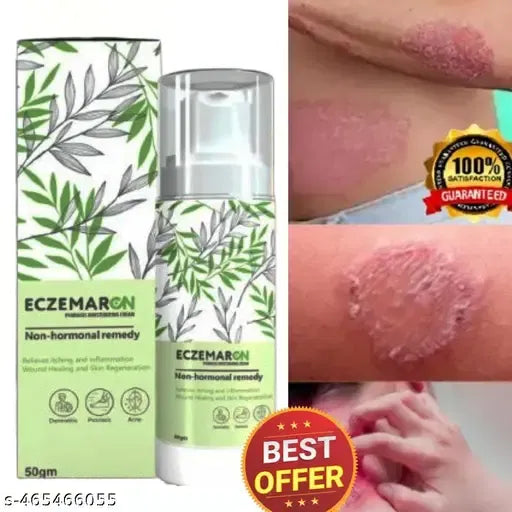 Eczemaron for Ringworm, itching, Eczema & Fungal Infection Anti Fungal Cream | (pack of 1)